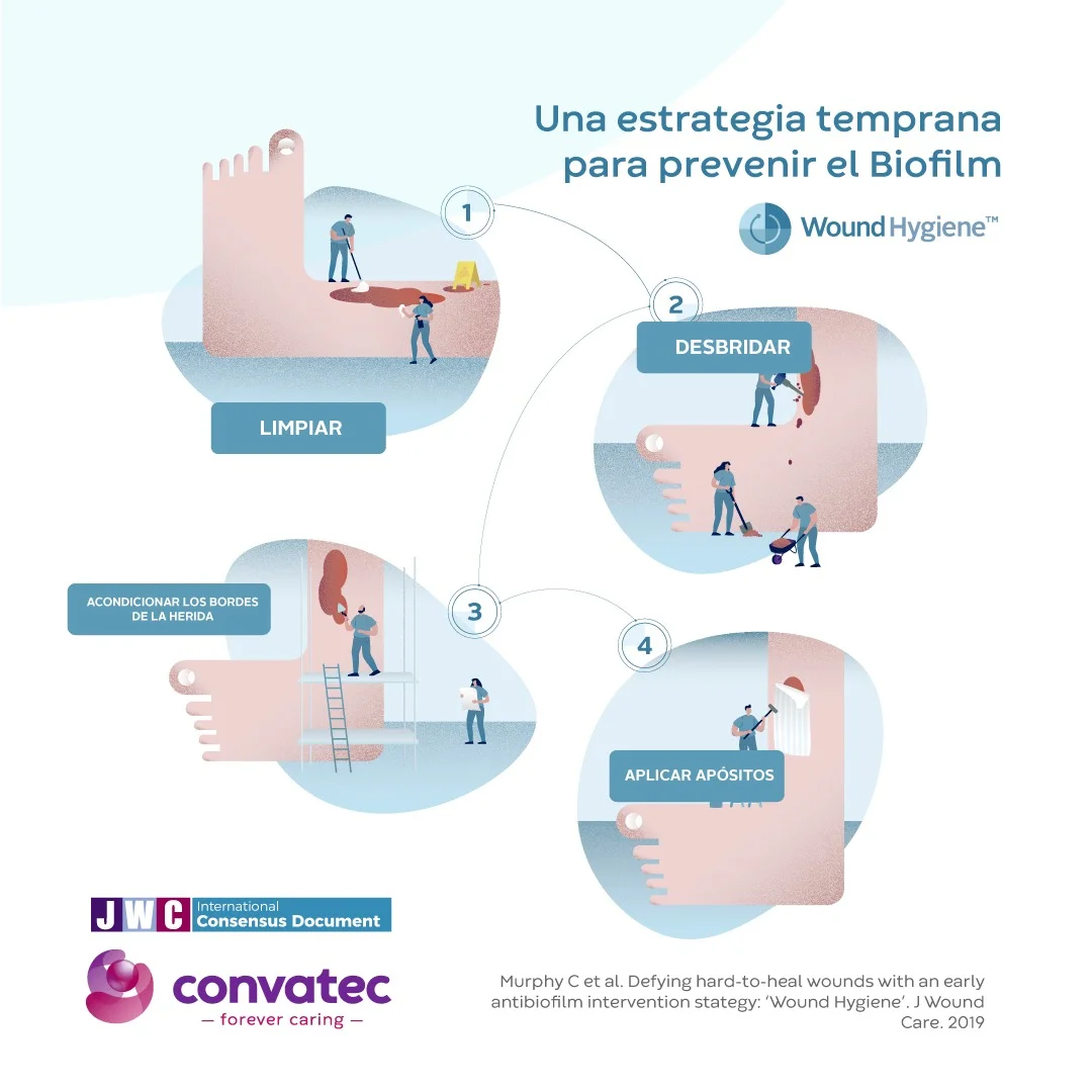 Una ilustración de dibujos animados de los pasos clave para la higiene de las heridas: limpiar, desbridar, acondicionar, colocar apósito