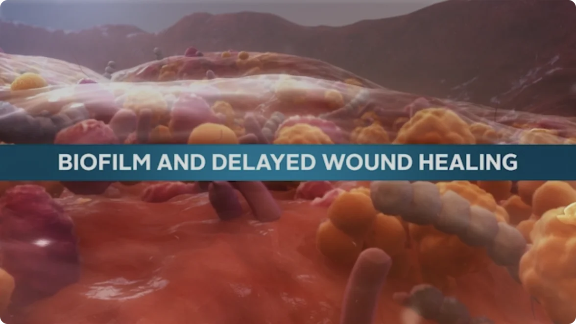 graphical user interface, text