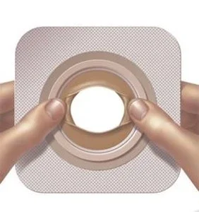 Convatec Moldable Technology™ Skin Barrierer