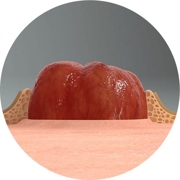 启用 LEAK-LOCK™ 技术